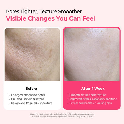 Cyano Pink Spicule Serum with Vitamin B12, Liquid Microneedle Facial Treatment for Enlarged Pores, Niacinamide for Texture Refining & Renewal, 1.01 fl.oz