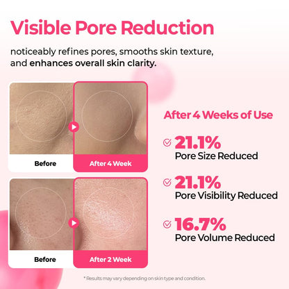 Cyano Pink Spicule Serum with Vitamin B12, Liquid Microneedle Facial Treatment for Enlarged Pores, Niacinamide for Texture Refining & Renewal, 1.01 fl.oz