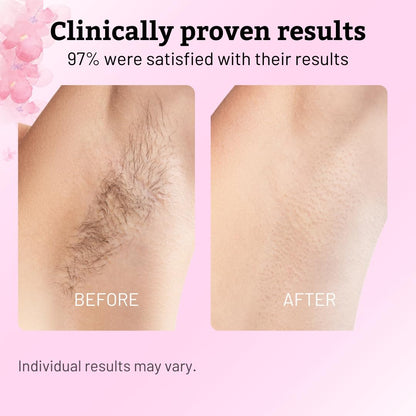 Cyperus Rotundus Oil for Natural Hair Reduction