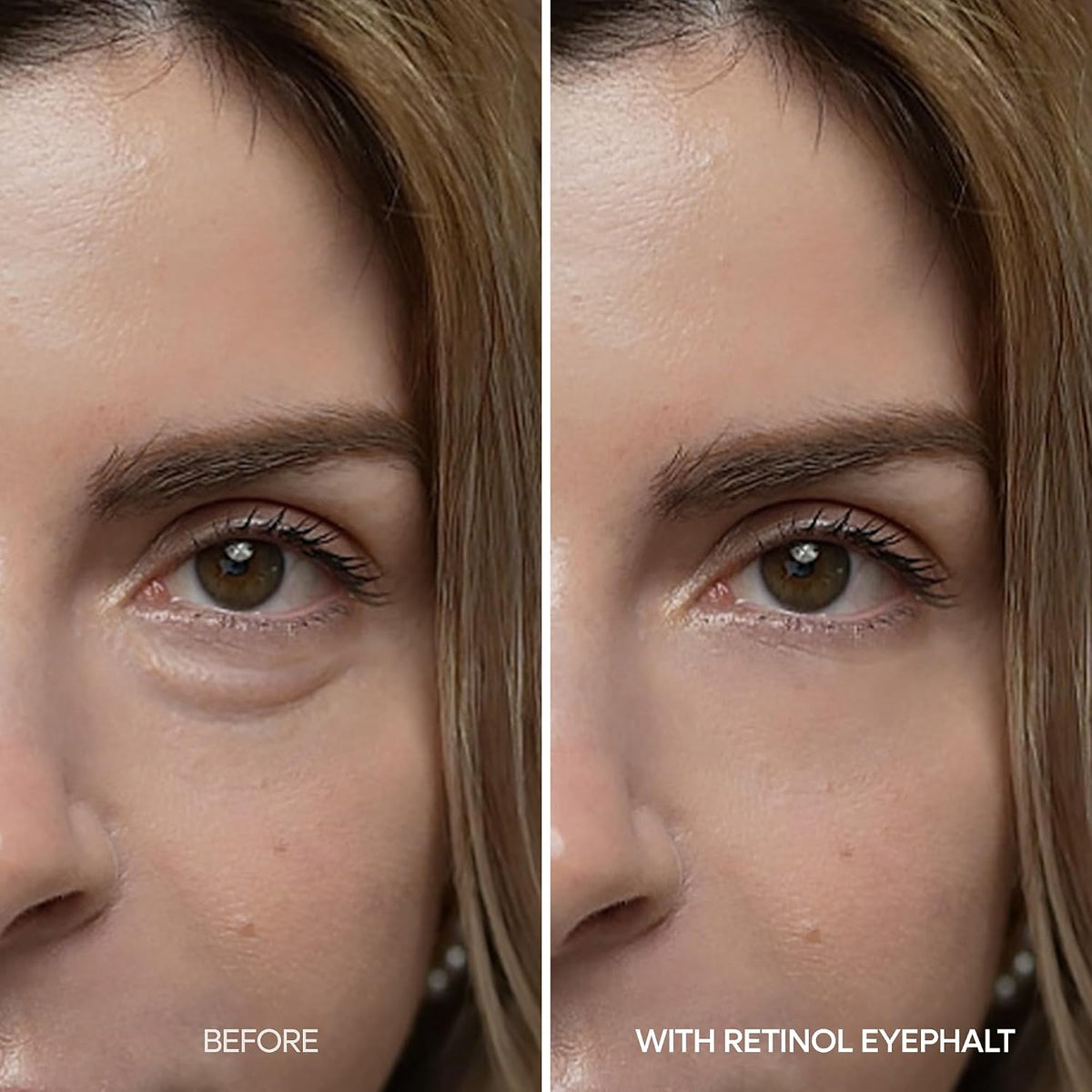 Retinol Eyebag Cream for Puffiness, Dark Circles & Fine Lines, Wrinkle, EGF Anti-Aging Under Eye Moisturizer with Niacinamide&Ceramide korean skin care