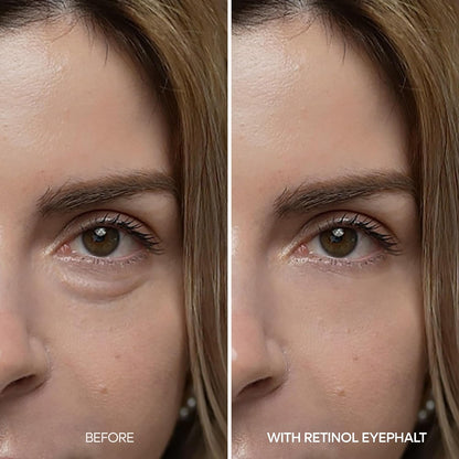 Retinol Eyebag Cream for Puffiness, Dark Circles & Fine Lines, Wrinkle, EGF Anti-Aging Under Eye Moisturizer with Niacinamide&Ceramide korean skin care