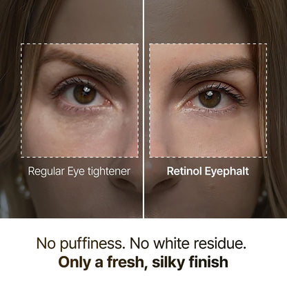 Retinol Eyebag Cream for Puffiness, Dark Circles & Fine Lines, Wrinkle, EGF Anti-Aging Under Eye Moisturizer with Niacinamide&Ceramide korean skin care