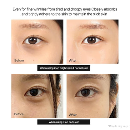 Korean Calcium Dark Spot Eye Cream 15g –  Dark Circles, Under Eye Bags & Sagging | Hydrolyzed Elastin EX Volume Firming