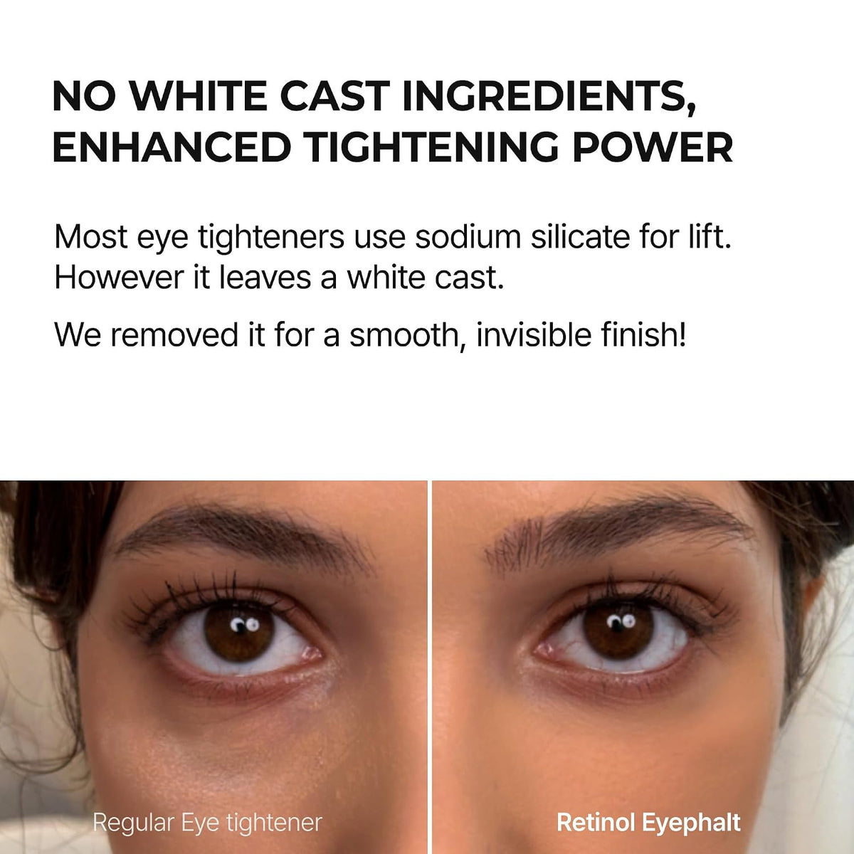 Retinol Eyebag Cream for Puffiness, Dark Circles & Fine Lines, Wrinkle, EGF Anti-Aging Under Eye Moisturizer with Niacinamide&Ceramide korean skin care