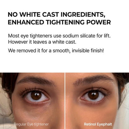 Retinol Eyebag Cream for Puffiness, Dark Circles & Fine Lines, Wrinkle, EGF Anti-Aging Under Eye Moisturizer with Niacinamide&Ceramide korean skin care