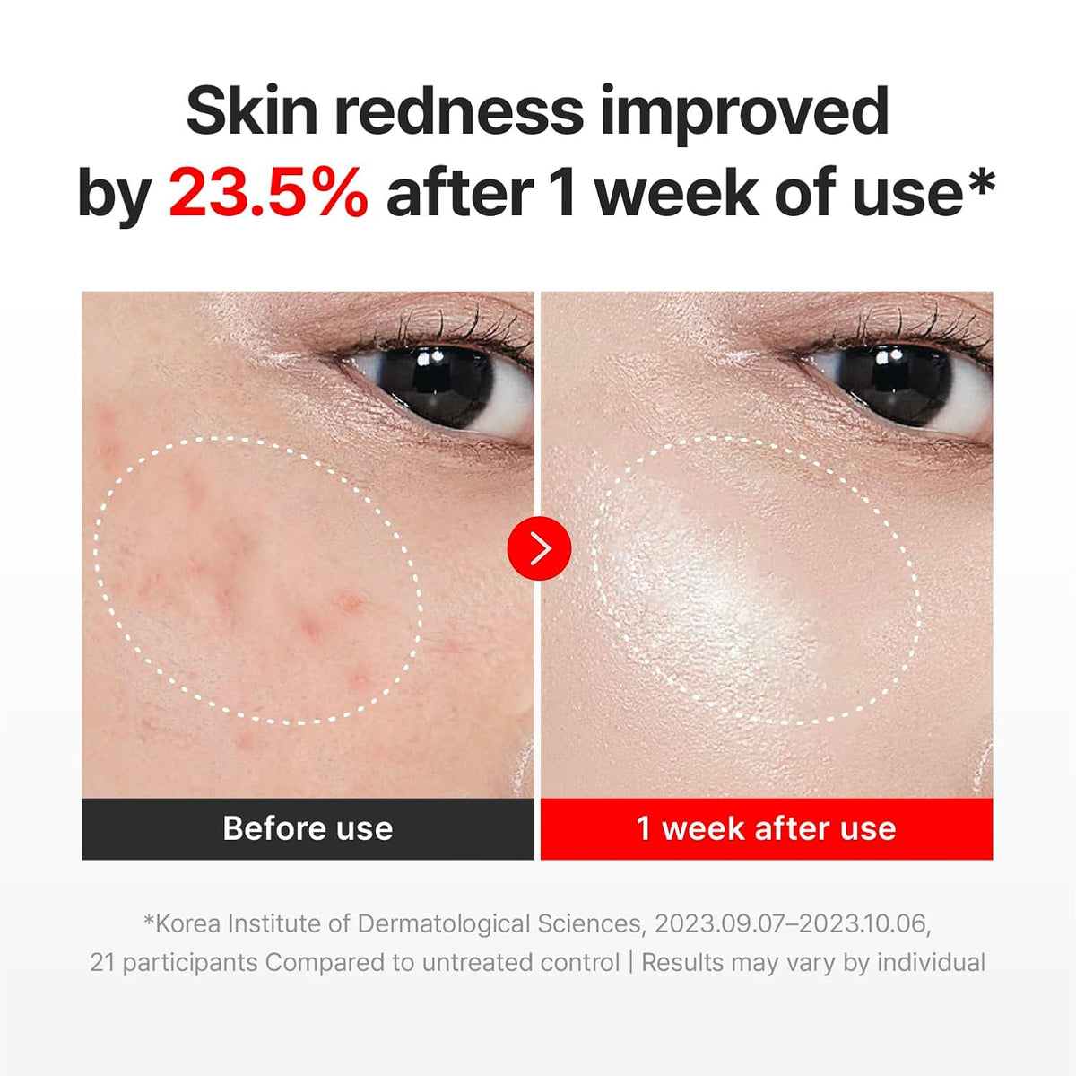 Madeca Time Reverse Cream – Korean Centella Anti-Aging Moisturizer | Hydrates, Firms & Reduces Wrinkles (1.69 fl oz)