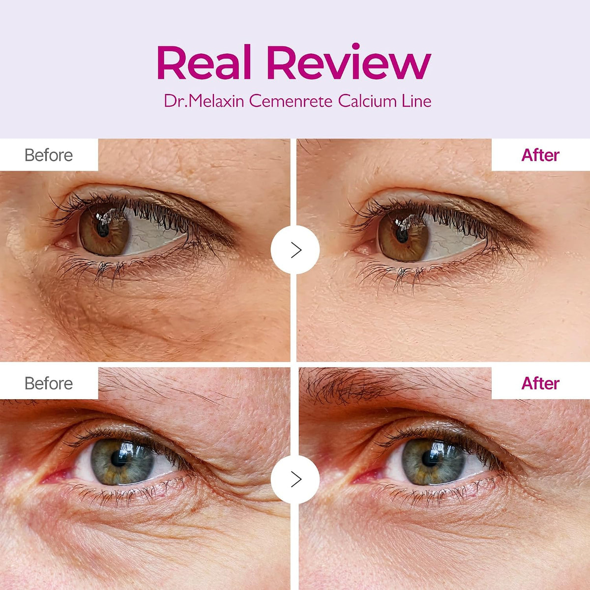 Firming Collagen Eye Patch Calcium Volume Under Eye Patches for Puffy Eyes & Dark Circles, Hydrogel Eye Mask for Wrinkles, Fine Lines & Sagging Skin,  Korean Skin Care (60 Count)
