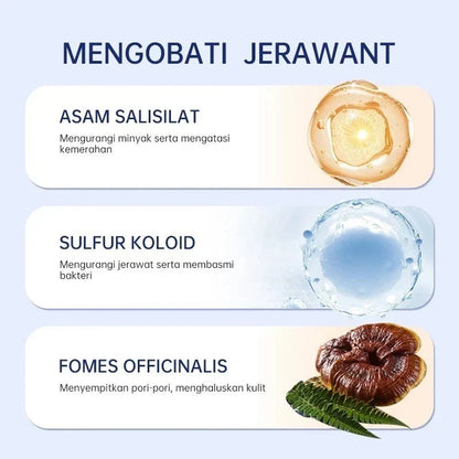 Pimple & Blemish Skin Management Essence | Treatment Drying Lotion | Manages Appearance , Aids Skin Resurfacing